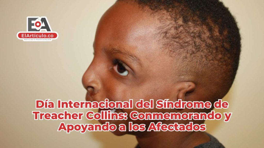 Día Internacional del Síndrome de Treacher Collins: Conmemorando y Apoyando a los Afectados - El ...
